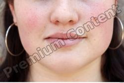 Mouth Woman White Birthmarks Average